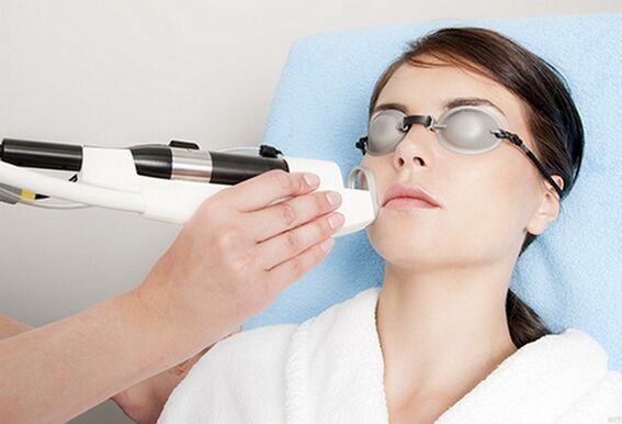 Laser procedure for skin rejuvenation