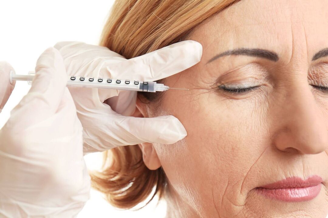 Mesotherapy is a method of intradermal administration of a drug with a rejuvenating effect. 