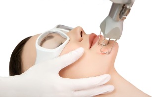 Laser rejuvenation of facial skin